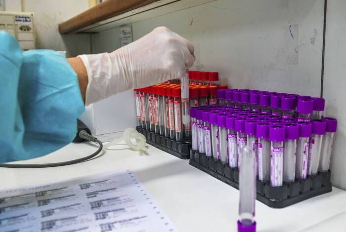 Paraíba confirma 955 novos casos de Covid-19 e 25 óbitos neste domingo Paraíba confirma 955 novos casos de Covid-19 e 25 óbitos neste domingo