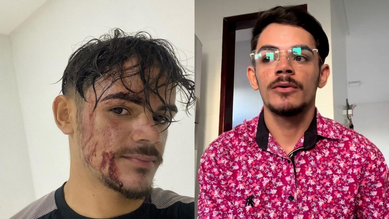 Motoboy que teve açaí arremessado no rosto após atraso de entrega vai acionar justiça contra cliente