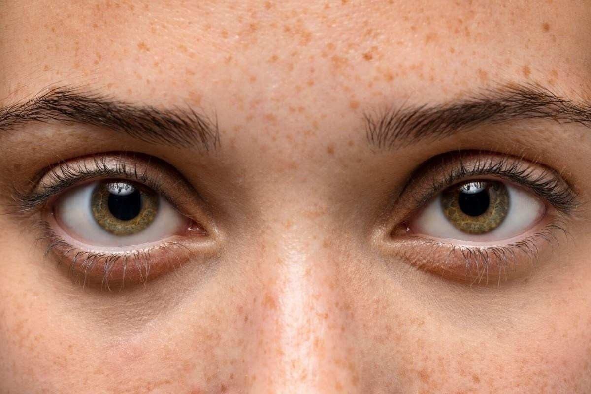Médicos alertam sobre riscos para saúde dos olhos durante Carnaval Olhos, Médicos, Alerta