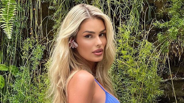 Lipedema, doença de Yasmin Brunet, atinge 12% das brasileiras; veja tratamentos A participante do BBB 24 revelou em conversa com os brothers sofrer com a doença