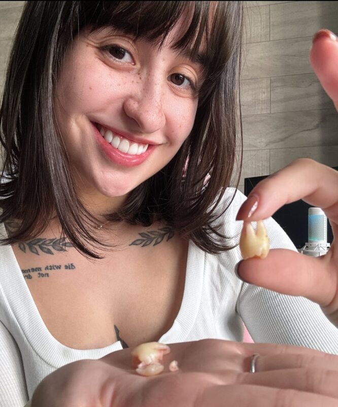 Influenciadora anuncia venda de dentes sisos por R$ 40 mil; prática é considerada crime Influenciadora, Dente siso, Martina oliveira