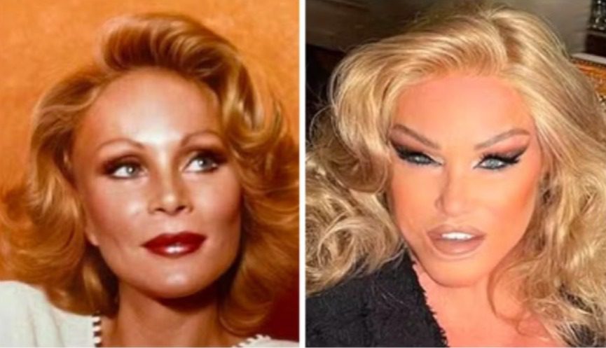 Jocelyn Wildenstein, a 'Mulher-Gato', choca internautas ao mostrar rosto antes de virar recordista em plásticas Jocelyn Wildenstein, a 'Mulher-Gato', choca internautas ao mostrar rosto antes de virar recordista em plásticas