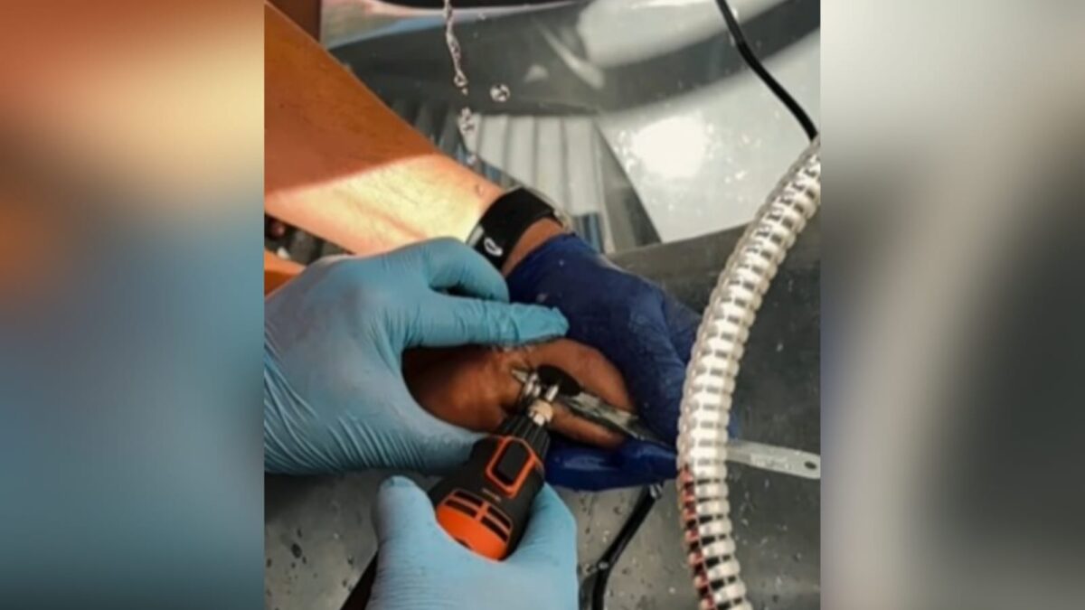 Bombeiros retiram dois anéis presos em dedo de mulher no Sertão da Paraíba bombeiros, aneis, dedo,
