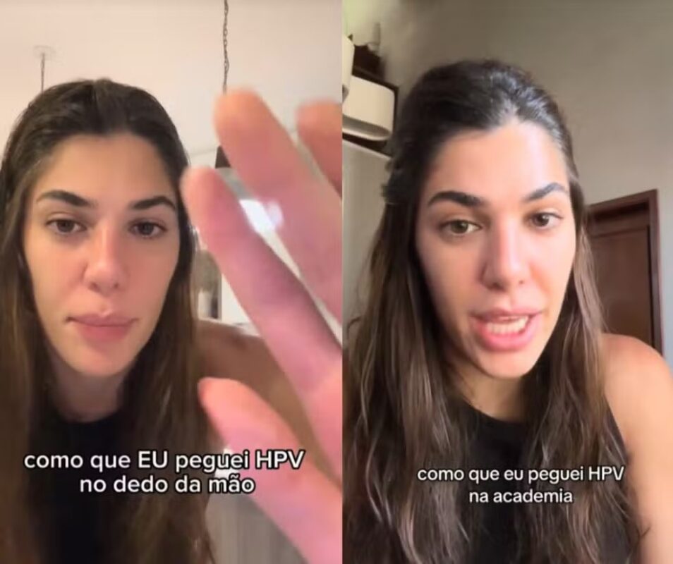 Dá para contrair HPV em aparelho da academia? Especialistas explicam hpv, aparelho, academia