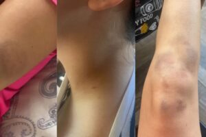 Influenciador Thiago Schutz é preso em flagrante por agredir namorada