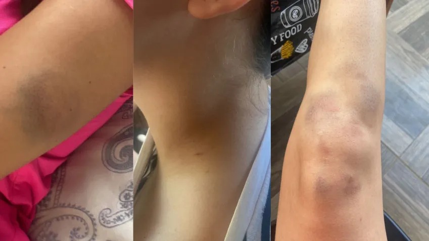 Influenciador Thiago Schutz é preso em flagrante por agredir namorada